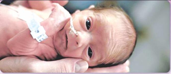 What Can Cause A Preterm Delivery?