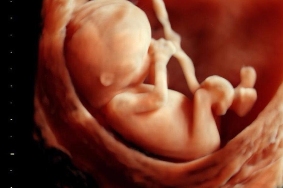 A story of birth and death in the same breath!