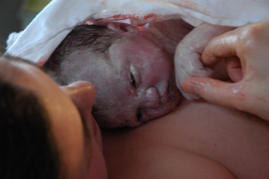 What Is Vernix Caseosa?