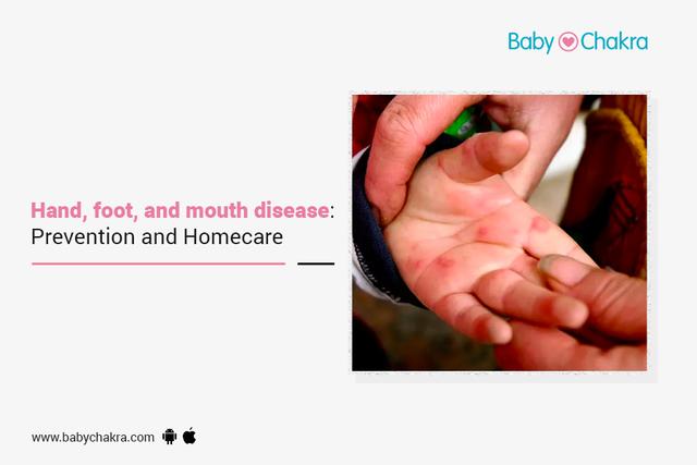 Hand, Foot, And Mouth Disease: Prevention And Homecare