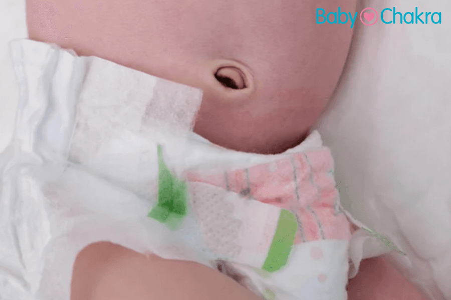 Newborn Belly Button Bleeding: How To Care And When To Worry