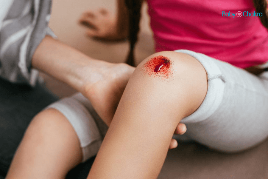 World Haemophilia Day: Understanding The Symptoms, Causes, And Prevention