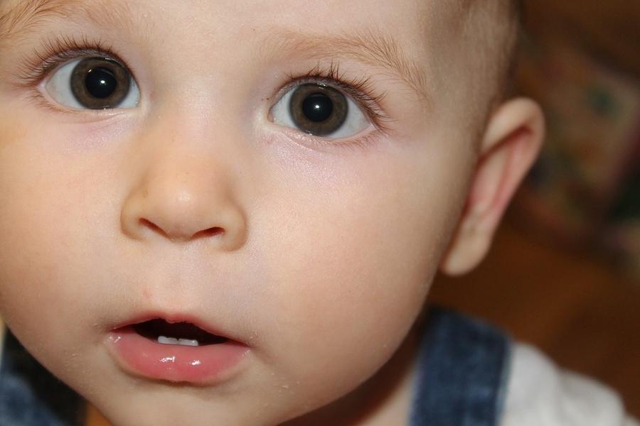 Squinting In Babies: When Is It A concern?