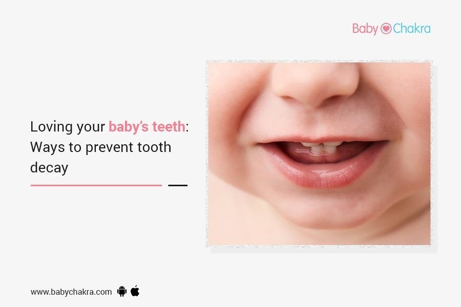 Loving Your Baby’s Teeth: Ways To Prevent Tooth Decay