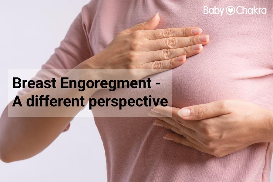 Breast Engoregment &#8211; A Different Perspective