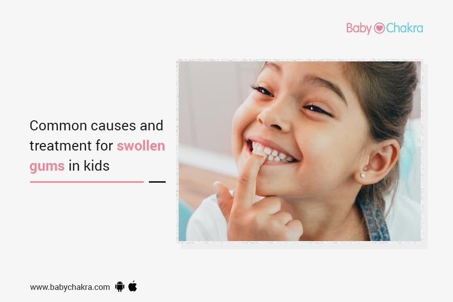 Common Causes And Treatment For Swollen Gums In Kids
