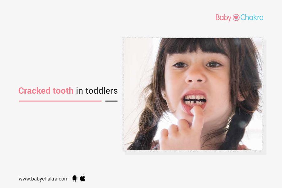 Cracked Tooth In Toddlers