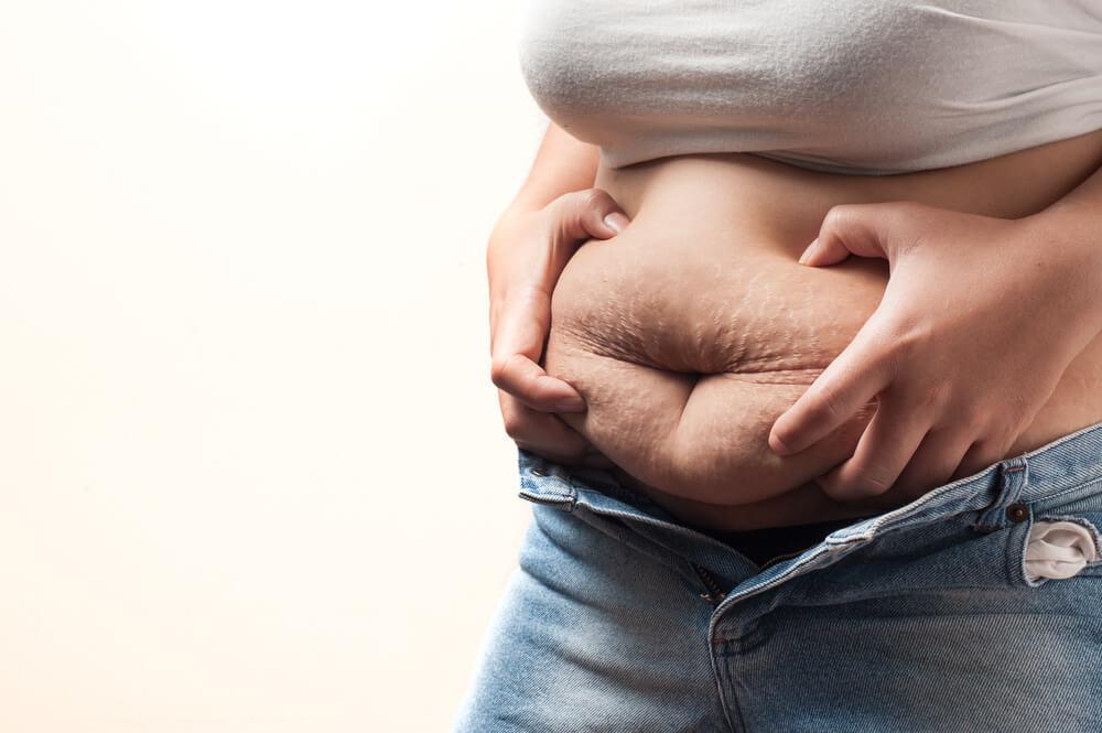 7 Husbands Reveal What They Think About Their Wifes Stretch Marks