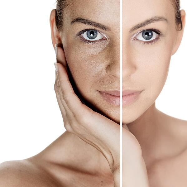 7 Simple Tips To Reduce The Appearance Of Enlarged Pores