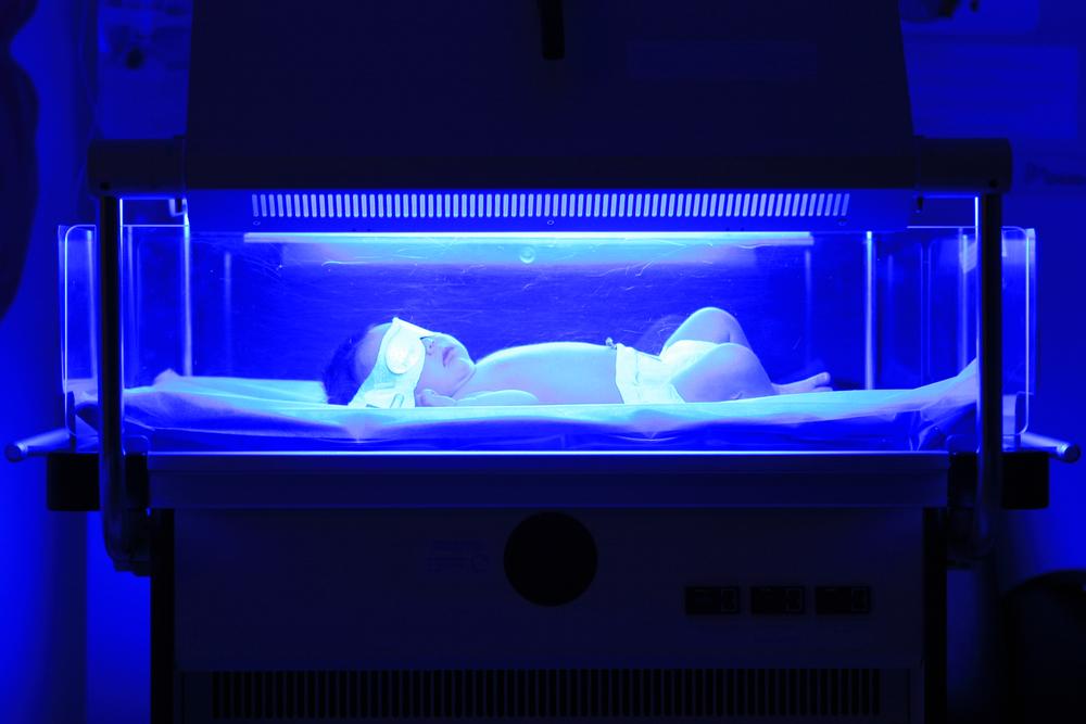 how to take care of jaundice in your newborn