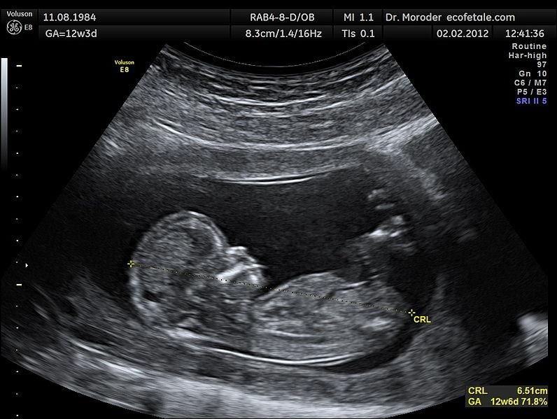 An Ultrasound Scan Report: A Treasure Box Of Information During Pregnancy