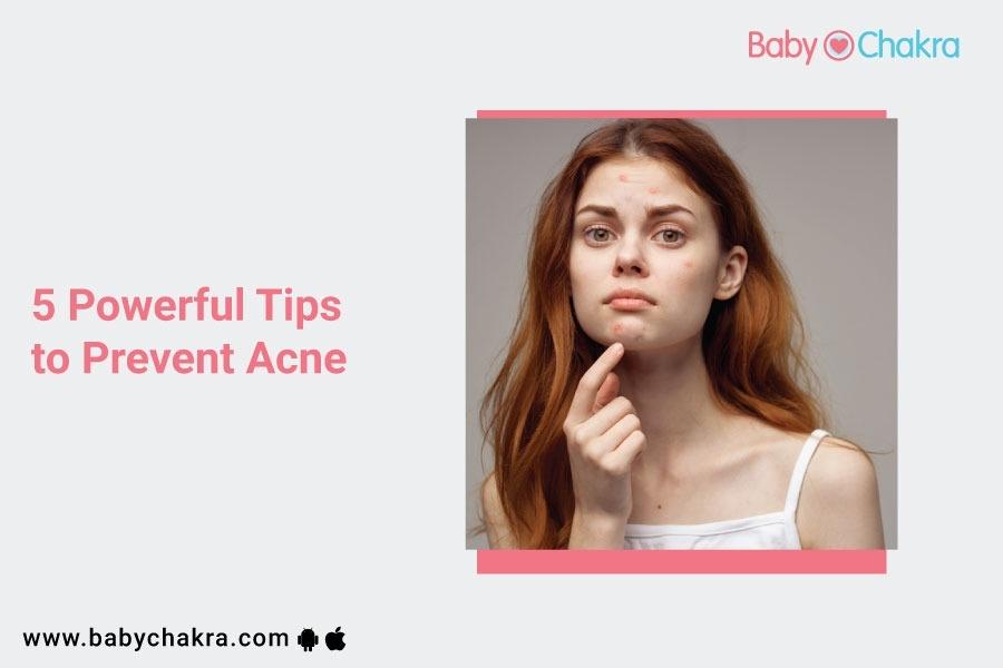 5 Powerful Tips To Prevent Acne