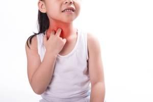 Eczema In Children Cause And Treatment 4 6 Years Xyz