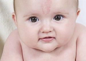 what does your childs birthmark say about them