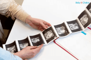 What Is A Fetal Echocardiogram Test And Why Is It Important?